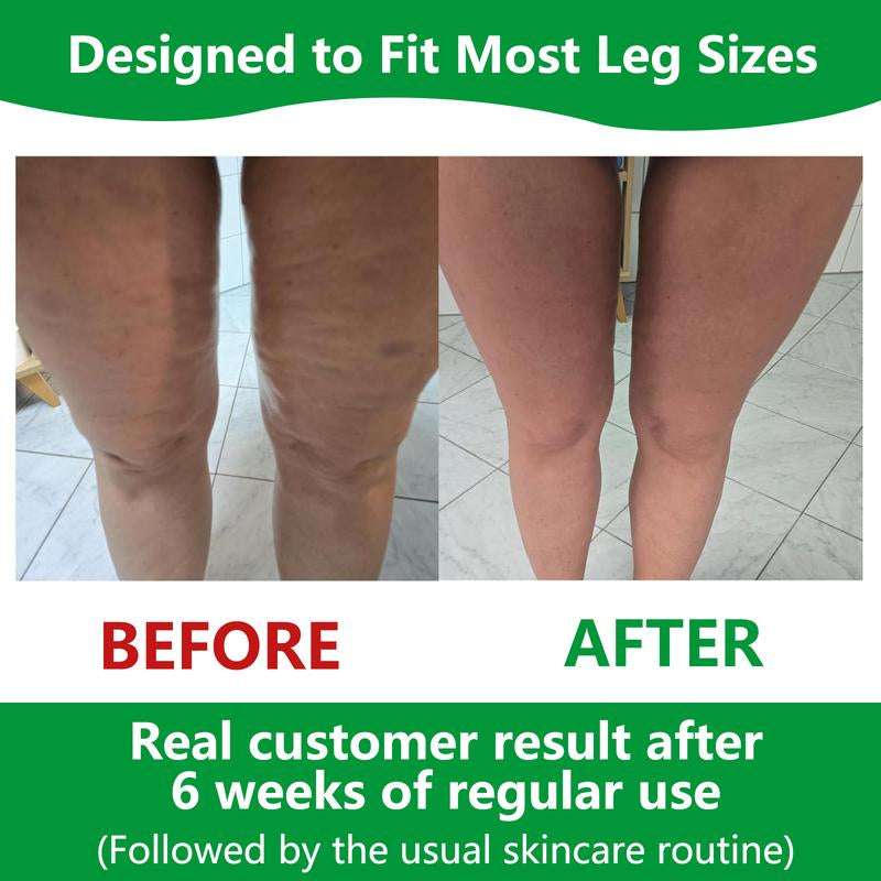 SmoothSkin Body Roller - VIP