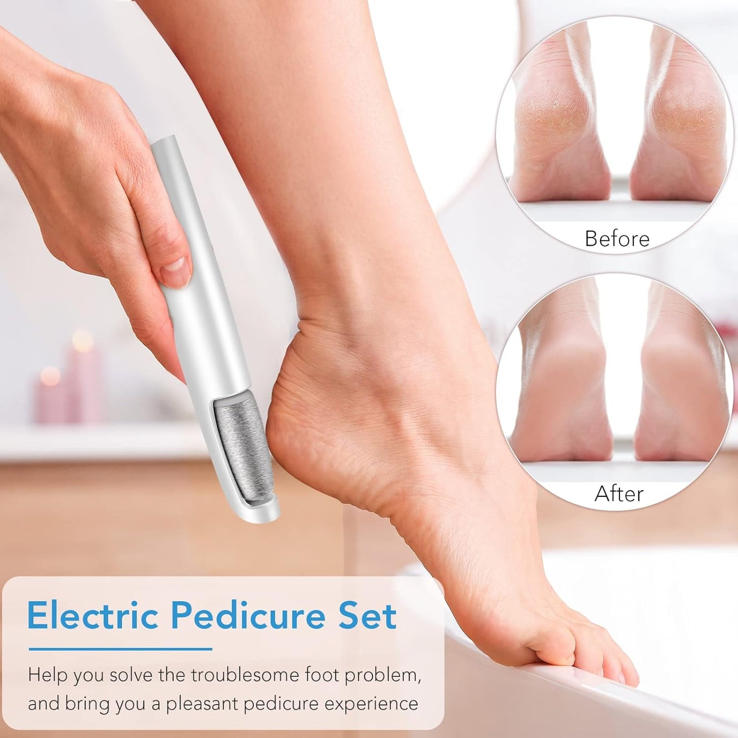 SmoothMagic™ Portable Electric Feet Callus Remover - VIP