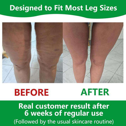SmoothSkin Body Roller - VIP